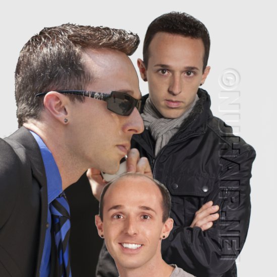 Hair Loss Bald Men Hair Replacement Dallas, DFW, Texas No Hair Transplants